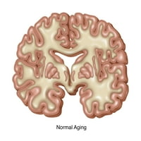 Normalno starenje mozga za starenje Ispis Gwen Shockey Science izvor